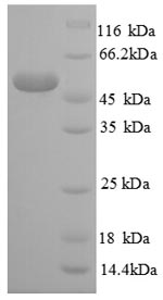 Human RPL14 protein
