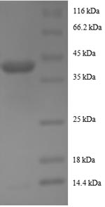Human AROS protein