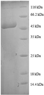 Human SM22 protein