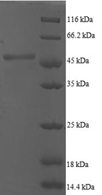 Human ARF5 protein