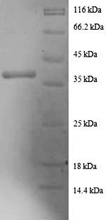 Human DAP1 protein