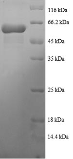 Human TPR1 protein