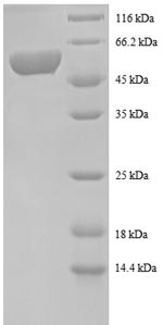 Human SPS1 protein