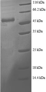 Human PSME2 protein