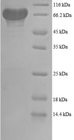 Human PGDH protein