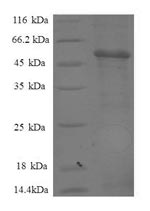 Human PSMB7 protein