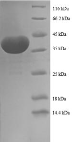 Human PFDN1 protein