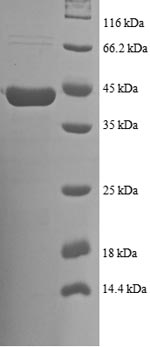 Human NDUFB7 protein