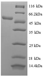 Human RPL18 protein