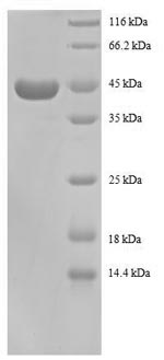 Human RPS13 protein