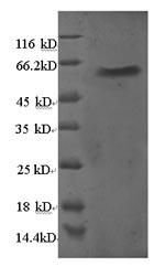 Human RPL5 protein