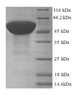Human RPL17 protein