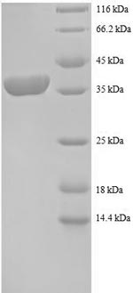 Human RPS12 protein