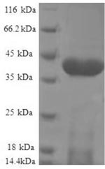 Human NDUFS5 protein