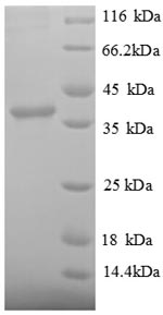 Human SRP14 protein