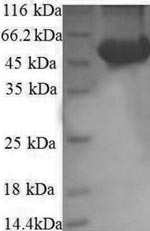 Human RPS6KB2 protein