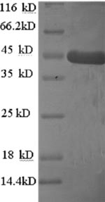 Human HOMER1 protein