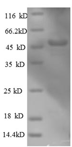 Human ARPC3 protein