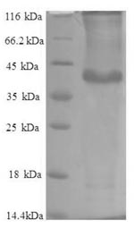 Human HCGV protein