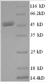 Human HBO1 protein