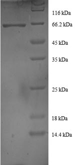 Human DNAJB1 protein