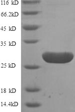 Human GPR161 protein
