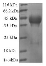 Human RPL35 protein