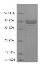Human PRO2640 protein