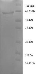 Human TAL protein