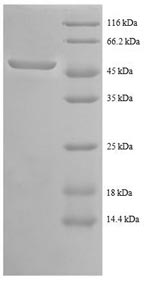 Human ABL protein