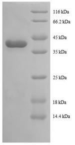 Human TAX1BP3 protein