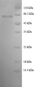 Human MDHA protein