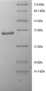 Human SLC20A3 protein