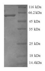 Human GNB2 protein