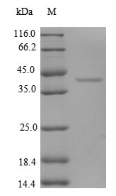 Human SUI1 EIF1 protein