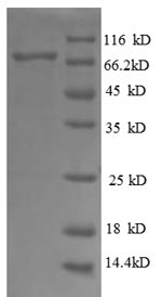 Human DDOST protein