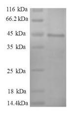 Human MYL6 protein
