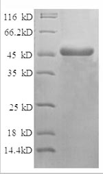 Human NDUFV2 protein
