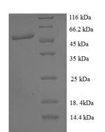 Human PICK1 protein
