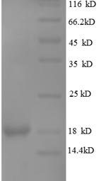 Human OB protein