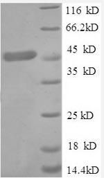 Human TNFR1 protein