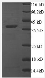 Human Thrombospondin-1 protein