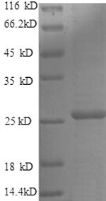 Human TIMP-4 protein