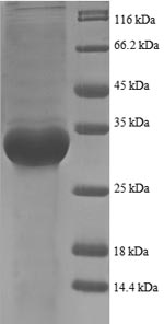 E.coli rpmI protein