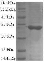 E.coli rpmH protein