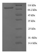 Human CD146 protein