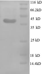 Human MDK protein