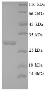 Human AIG1 protein