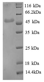 Human ENO3 protein
