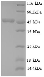 E. coli metC protein